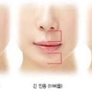인중산업 이미지