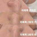 대평로90번길 | 수원정자동피부관리 바네피부앤왁싱 방문 후기 피부 임산부왁싱 찐 추천