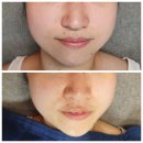 캔디스뷰티살롱 | 분당피부관리, 정자동 캔디스뷰티