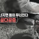 [942회]생로병사의 비밀/[뼈가 무너지면 몸이 무너진다,골다공증]넘어져도 툭툭 털고 일어날 수 있는 건 우리 몸을 지탱하는 건강... 이미지