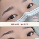 엘핀뷰티