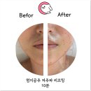 닥터아이티엔파주점 | 파주피부관리 리프팅 잘하는 곳 금손네일 닥터아이티엔 파주점