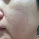 수풀林 | 줄기세포앰플 세림샵 투엠셀 콜라겐 펩타이드 액티브 앰플 사용 후기