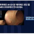 엔도메드 이미지