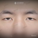 케이스성형외과의원 네이버블로그
