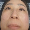 뽀글뽀글&눈썹 이미지