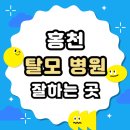 지에스25 홍천아산병원점 | 홍천 탈모 전문 병원 두피 탈모관리 잘하는 곳 추천 List
