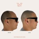 TMW 탈모왕수원 이미지