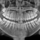 사랑니를부탁해구강악안면외과치과의원 이미지