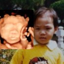 똘래랑스 | 25w 임당검사, 입체초음파, 자궁경부 짧음 이슈 (타잔이 미모 공개)