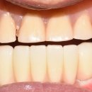 연세아라치과 이미지