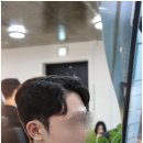 연희헤어라인 이미지