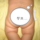 울아기 고관절 탈구 의심해봐야 하는지 좀 봐주세요 (사진있어요) 이미지