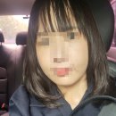 청담약국 | 청담역 피부과 추천 이마 필러 내돈내산 후기