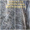 꺾인머리 꺽인머리 복구매직 복구펌 전문 김송정머리터 신논현역 미용실 이미지
