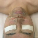 유하메디칼 | 분당 서현역 유하에스테틱, 스피큘 필링 모공 피부결 압출 피부관리 리얼 후기