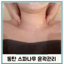동탄역마사지 윤곽관리 스파나무동탄점 후기