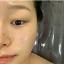 보민 에스테틱 | 화명동 탄력 피부관리 잘하는 동안에스테틱
