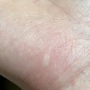 pet107너 1812 | 1025 (2)