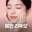 아임유(I m u) | 용인리투오 기대와 다르게 느껴지는 이유 <참고>