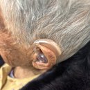 평택보청기 | 평택보청기 102세 어르신 보청기 구매 후기 스타키평택센터