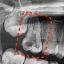 수원탑플란트치과의원 이미지