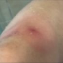 멍달구리 이미지