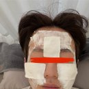 청주 ‘S' 의원 방문기 6편｜3회차 시술 후기 PN주사 2cc, DCM 초음파 재생모드, LED재생레이저, 모델링팩