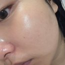 자세리커버리연구소 | 약국기미크림 :: 닥터프리메틱 크림 기미 미백 | 기미개선크림 추천