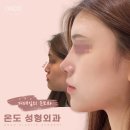 온도성형외과의원 이미지