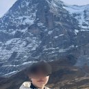 노벨의원 | 신촌 노벨의원 남자 레이저제모 12회 진행완