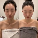 세븐일레븐 광주첨단라인점 | 광주 작은얼굴 관리 잘하는 곳 | 첨단 윤곽관리, 바디관리 후기 에스테티아 첨단1호점