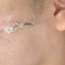 털찐 몽몽이 | 광주 수완지구 흑석동 뷰티온유 스킨플래닝 잘하는곳 갈바닉 진정 보습