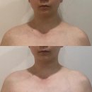 선오월 | 광주피부관리 오월에스테틱 JH윤곽술 후기 신부관리 추천