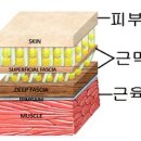 바이칼휘트니스 이미지