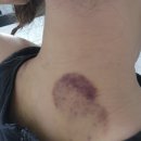 바디핏 EMS | well247 바디컷튠핏 마사지기 &amp; 튠부스팅젤 사용 후기! 부황마사지기 흡입 온열 ems 효과와 건강 정보