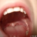 올치과의원 | 서울치과 스마트올치과의원 높은 만족도의 비결