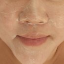 승모근 관리에서 피부관리까지, 영주 피부샵 설렘 물광 관리 후기