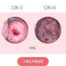 인달 이미지