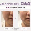 리턴스킨 이미지