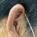 효자보청기 이미지