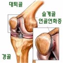 연골 이미지