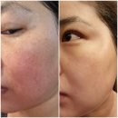김포성공인셀덤 | 인셀덤 후기 - 22일~ 25일차