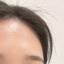 [내돈내산] 부활비타민앰플로 화석기미 없애는법, 2주간 써본 솔직후기