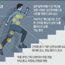 계단을 올라갈 때와 내려갈 때, 근육통이 발생하기 쉬운 쪽은? 이미지