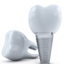 e편한치과기공소 | 안산치과 후기 추천 받고자 할 때 확인할 부분들?