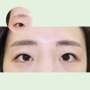 홍대 점막 아이라인 반영구 후기에서 봐야하는 부분
