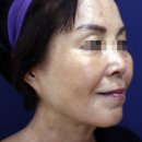 리뉴미피부과의원 이미지