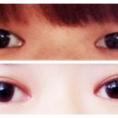 우아성형외과의원 이미지