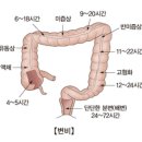 오즈 정약국 | 변비약 증상에 따라 달리 복용